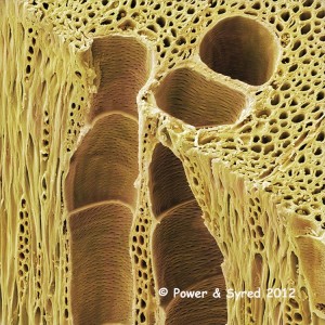 ash-wood-xylem--sem--80201907-l    